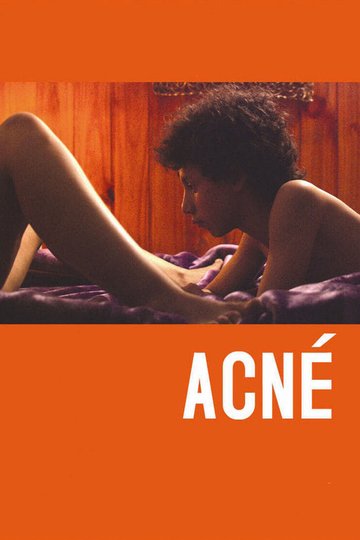 Locandina di Acné