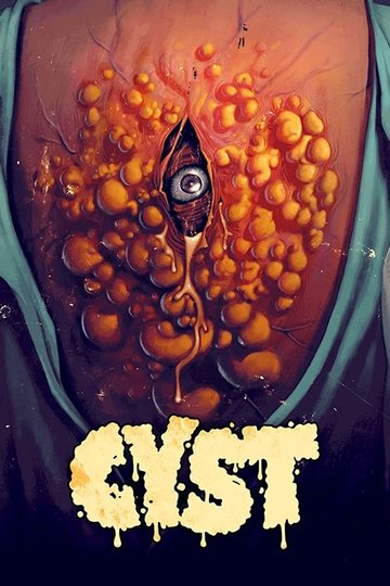 Locandina di Cyst - La ciste assassina